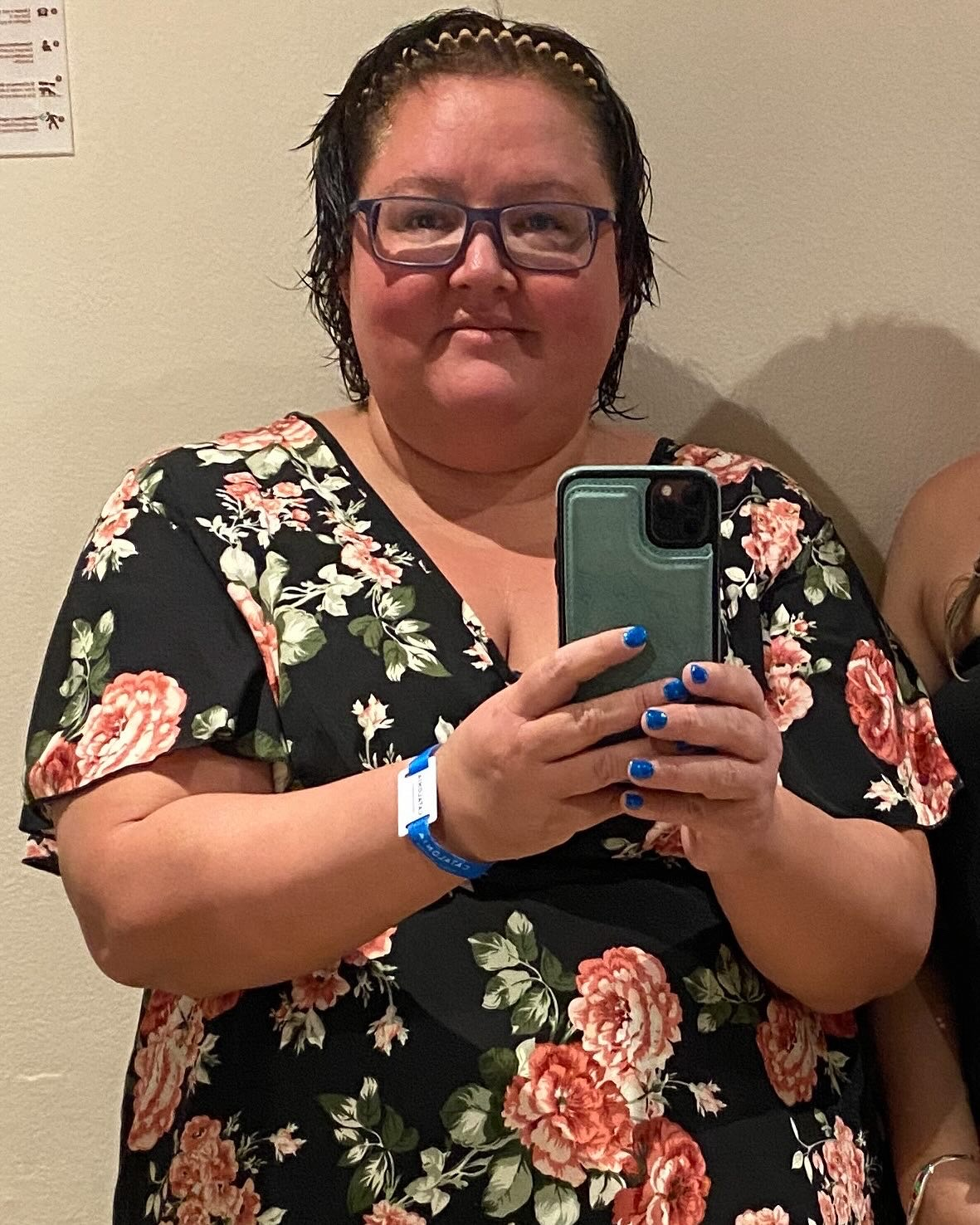 Jackie before the carnivore diet